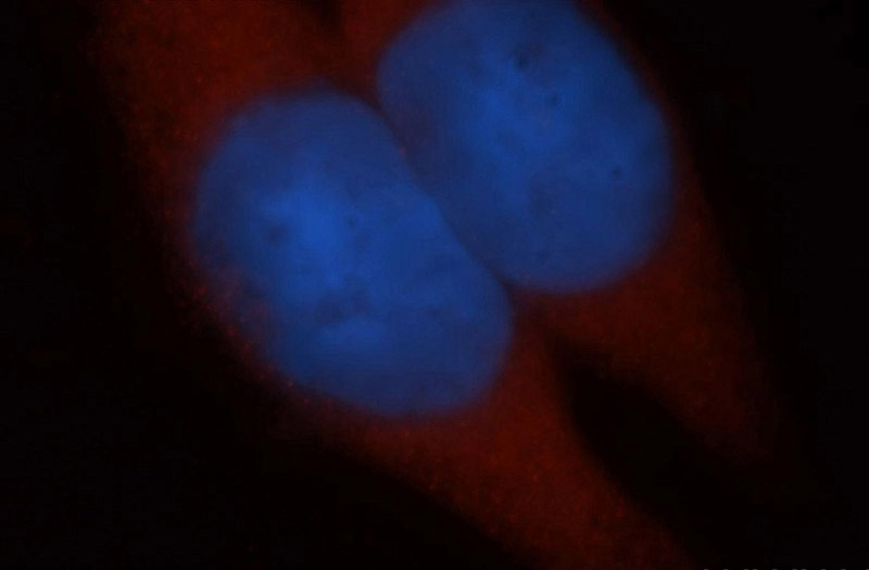 Immunofluorescent analysis of MCF-7 cells, using ADH6 antibody Catalog No:107789 at 1:50 dilution and Rhodamine-labeled goat anti-rabbit IgG (red). Blue pseudocolor = DAPI (fluorescent DNA dye).