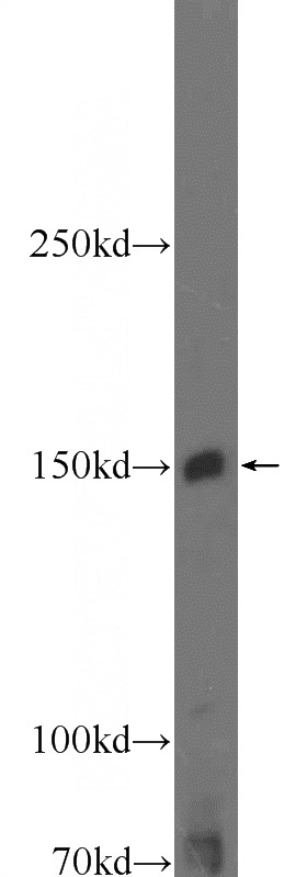 Jurkat cells were subjected to SDS PAGE followed by western blot with Catalog No:111879(JAK2 Antibody) at dilution of 1:600