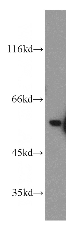 HeLa cells were subjected to SDS PAGE followed by western blot with Catalog No:112076(KLF10 antibody) at dilution of 1:100