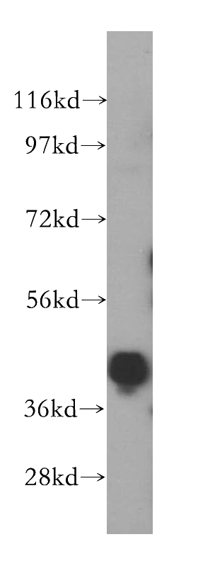 HeLa cells were subjected to SDS PAGE followed by western blot with Catalog No:111505(hnRNP-E1 antibody) at dilution of 1:500