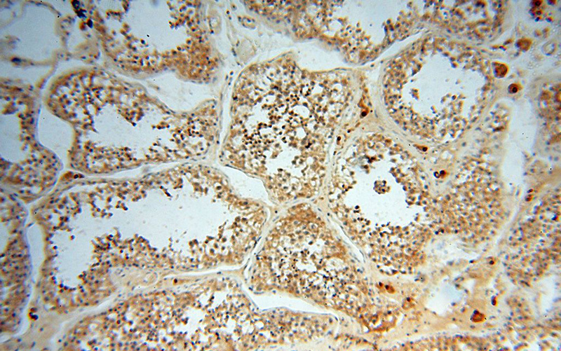 Immunohistochemical of paraffin-embedded human testis using Catalog No:114860(RTKN2 antibody) at dilution of 1:50 (under 10x lens)