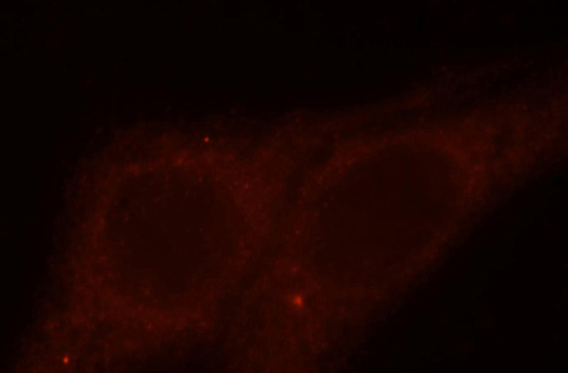 Immunofluorescent analysis of HepG2 cells, using DLC1 antibody Catalog No:109986 at 1:25 dilution and Rhodamine-labeled goat anti-rabbit IgG (red).
