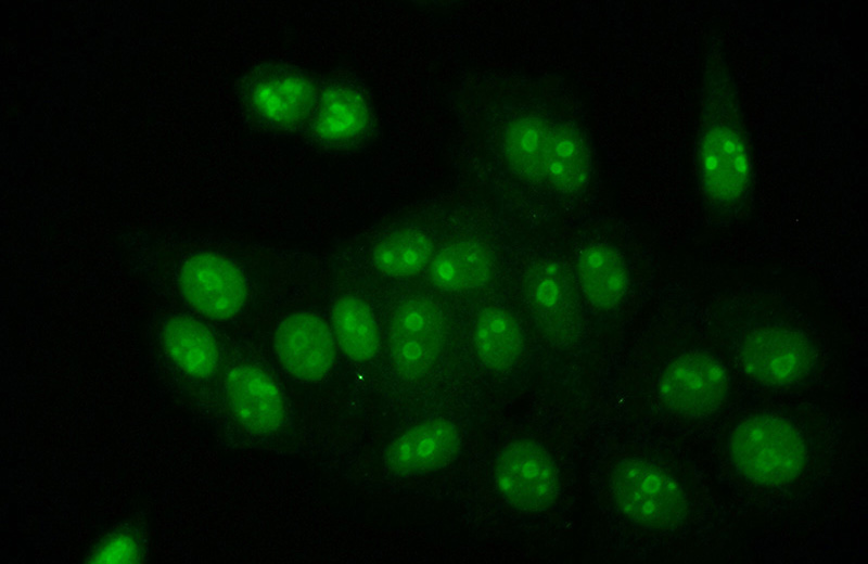 Immunofluorescent analysis of (10% Formaldehyde) fixed MCF-7 cells using Catalog No:111367(Histone H1.2 Antibody) at dilution of 1:50 and Alexa Fluor 488-congugated AffiniPure Goat Anti-Rabbit IgG(H+L)