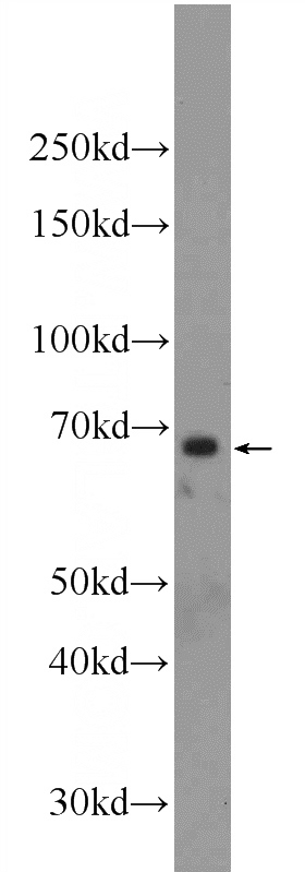 HepG2 cells were subjected to SDS PAGE followed by western blot with Catalog No:110746(FOXA2 Antibody) at dilution of 1:1000