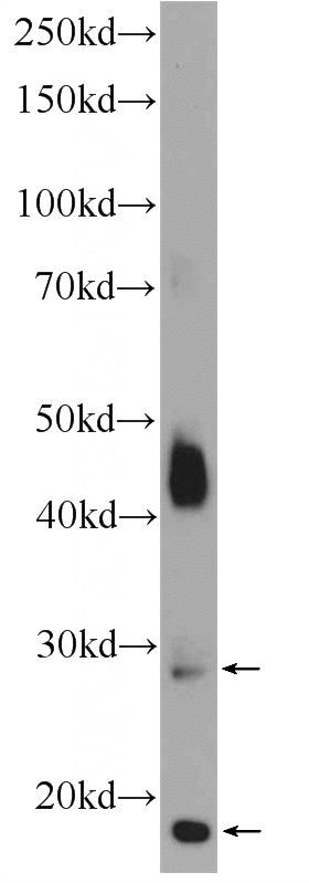 mouse skeletal muscle tissue were subjected to SDS PAGE followed by western blot with Catalog No:116110(TMEM182 Antibody) at dilution of 1:300