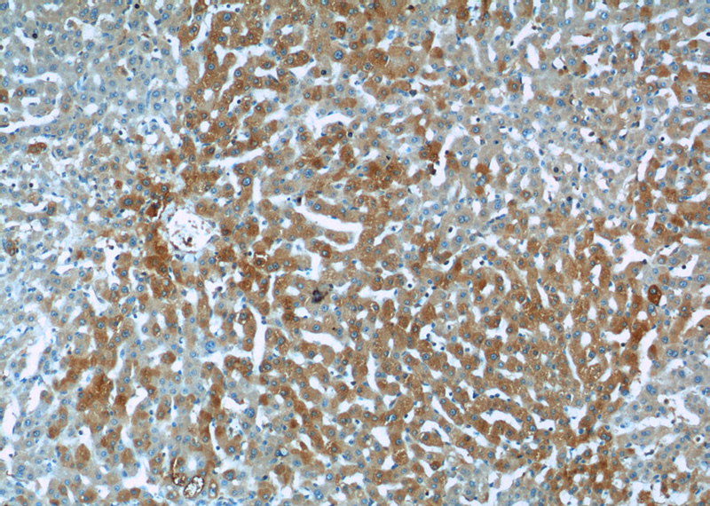 Immunohistochemistry of paraffin-embedded human liver tissue slide using Catalog No:112137(KTELC1 Antibody) at dilution of 1:50 (under 10x lens)