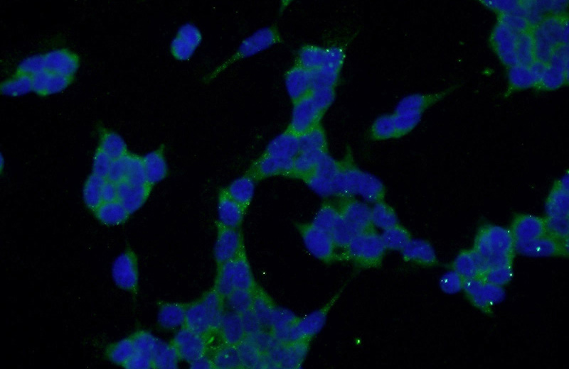 Immunofluorescent analysis of HEK-293 cells using Catalog No:115528(SPACA3 Antibody) at dilution of 1:50 and Alexa Fluor 488-congugated AffiniPure Goat Anti-Rabbit IgG(H+L)