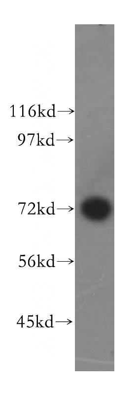 human brain tissue were subjected to SDS PAGE followed by western blot with Catalog No:110867(GARS antibody) at dilution of 1:500