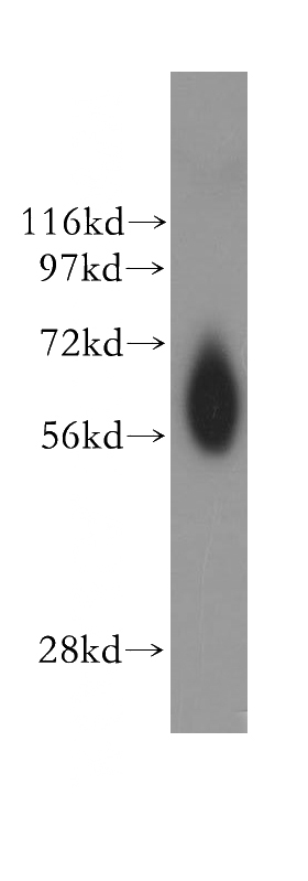 human spleen tissue were subjected to SDS PAGE followed by western blot with Catalog No:113056(NDOR1 antibody) at dilution of 1:500