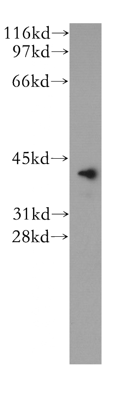 human brain tissue were subjected to SDS PAGE followed by western blot with Catalog No:116717(VASH1 antibody) at dilution of 1:500