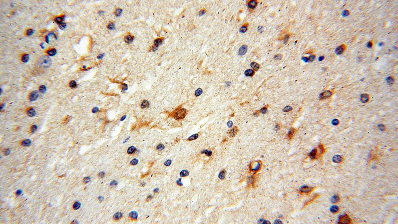 Immunohistochemical of paraffin-embedded human brain using Catalog No:114962(S100A5 antibody) at dilution of 1:100 (under 40x lens)
