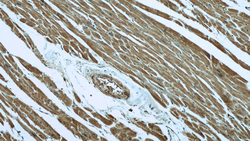 Immunohistochemical of paraffin-embedded human heart using Catalog No:107239(DES antibody) at dilution of 1:50 (under 10x lens)