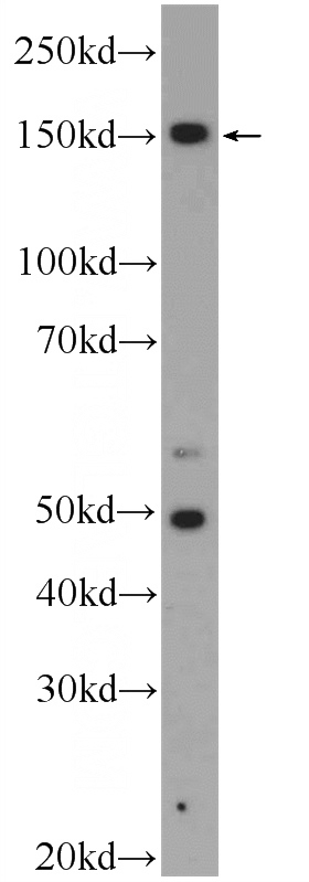 HEK-293 cells were subjected to SDS PAGE followed by western blot with Catalog No:117265(ZRANB3 Antibody) at dilution of 1:600