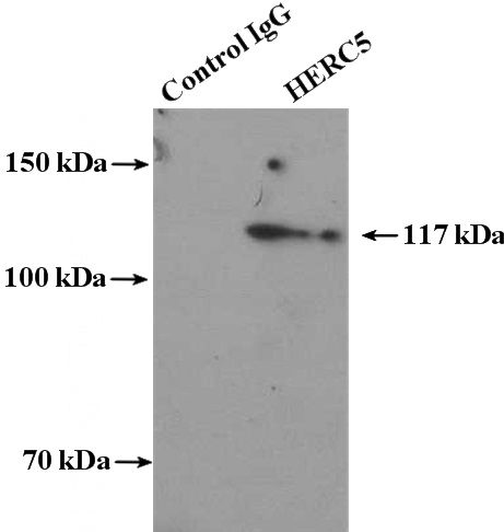 IP Result of anti-HERC5 (IP:Catalog No:111297, 4ug; Detection:Catalog No:111297 1:300) with HEK-293 cells lysate 2800ug.