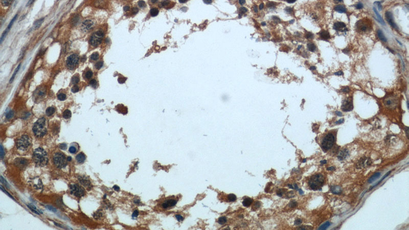 Immunohistochemical of paraffin-embedded human testis using Catalog No:109532(CPT1C antibody) at dilution of 1:50 (under 40x lens)