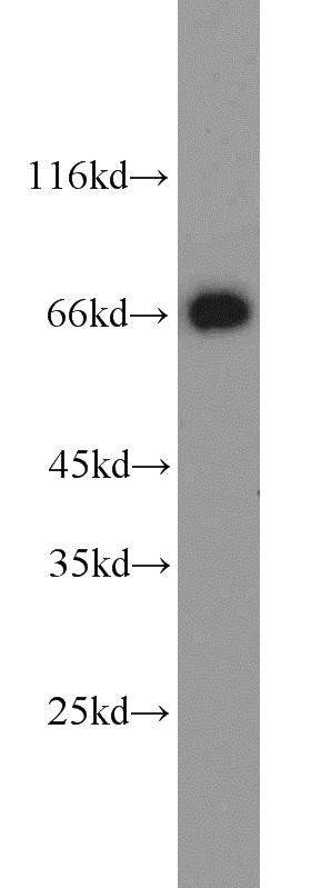 human brain tissue were subjected to SDS PAGE followed by western blot with Catalog No:107912(AFP antibody) at dilution of 1:2000