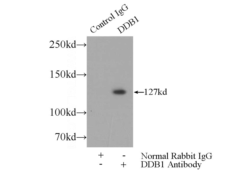 IP Result of anti-DDB1 (IP:Catalog No:109770, 5ug; Detection:Catalog No:109770 1:500) with Jurkat cells lysate 3080ug.
