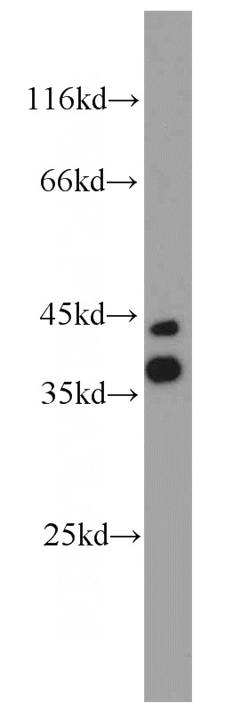 mouse brain tissue were subjected to SDS PAGE followed by western blot with Catalog No:108822(CALHM1 antibody) at dilution of 1:1000