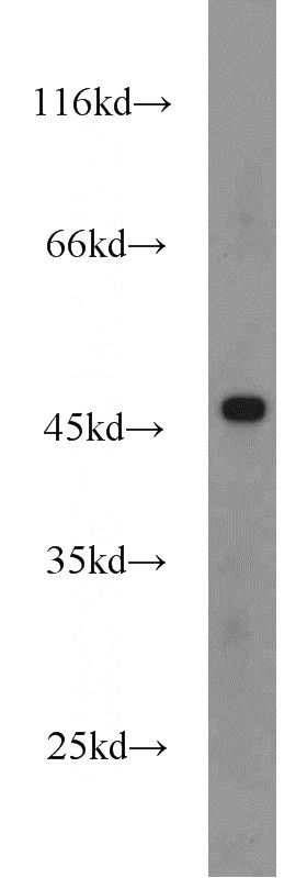 HEK-293 cells were subjected to SDS PAGE followed by western blot with Catalog No:110710(FOXP3 antibody) at dilution of 1:1000