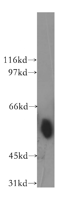 mouse brain tissue were subjected to SDS PAGE followed by western blot with Catalog No:115937(TEKT2 antibody) at dilution of 1:300