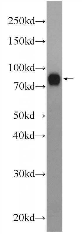 mouse liver tissue were subjected to SDS PAGE followed by western blot with Catalog No:111812(INTU Antibody) at dilution of 1:1000