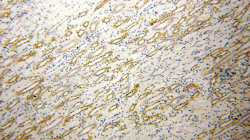 Immunohistochemical of paraffin-embedded human kidney using Catalog No:110960(GGPS1 antibody) at dilution of 1:100 (under 10x lens)