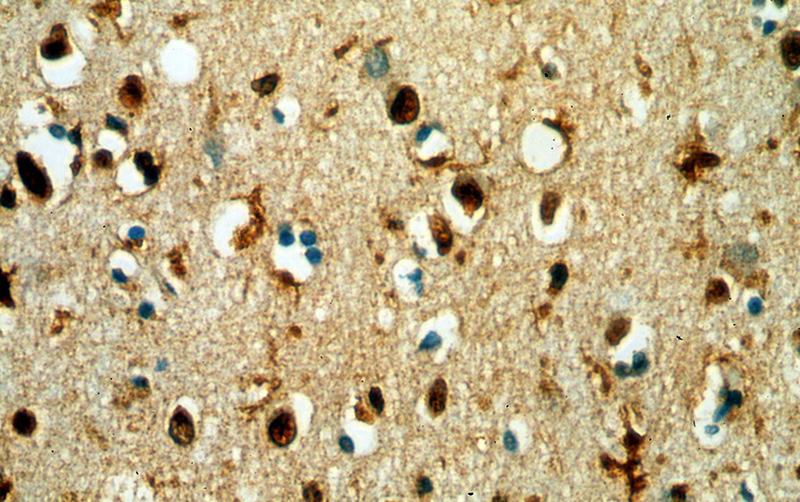 Immunohistochemical of paraffin-embedded human brain using Catalog No:115897(SII-TFIIS,TCEA1 antibody) at dilution of 1:400 (under 40x lens)