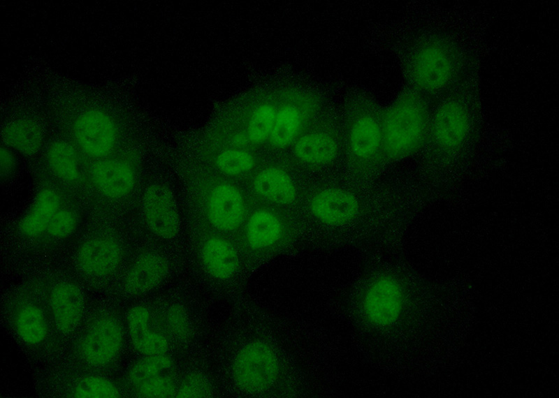 Immunofluorescent analysis of (10% Formaldehyde) fixed MCF-7 cells using Catalog No:113635(PDPK1 Antibody) at dilution of 1:50 and Alexa Fluor 488-congugated AffiniPure Goat Anti-Rabbit IgG(H+L)