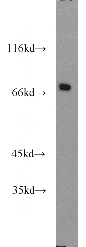 RAW264.7 cells were subjected to SDS PAGE followed by western blot with Catalog No:108814(CADM4 antibody) at dilution of 1:1000