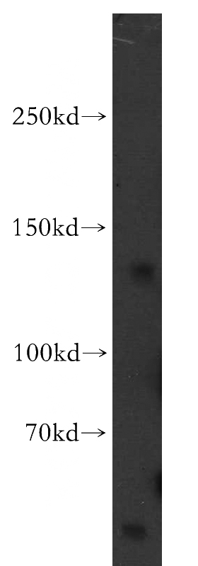 human brain tissue were subjected to SDS PAGE followed by western blot with Catalog No:111964(KCNH7 antibody) at dilution of 1:500