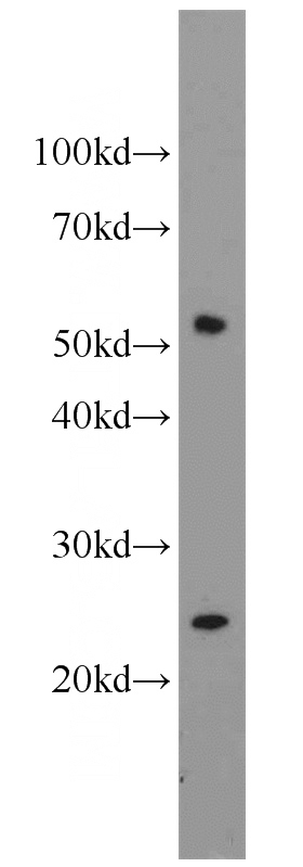 Jurkat cells were subjected to SDS PAGE followed by western blot with Catalog No:109576(CROP antibody) at dilution of 1:600