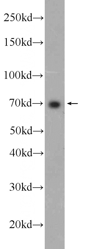 HepG2 cells were subjected to SDS PAGE followed by western blot with Catalog No:115850(TAP1 Antibody) at dilution of 1:1000