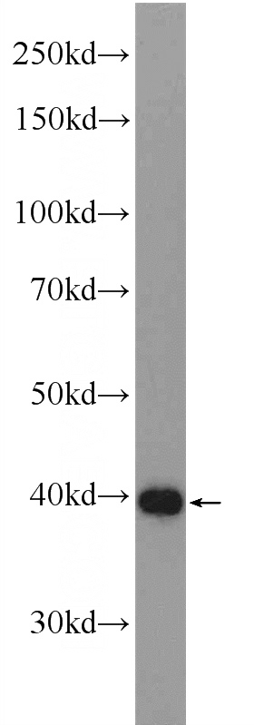 rat brain tissue were subjected to SDS PAGE followed by western blot with Catalog No:113342(OLIG2 Antibody) at dilution of 1:600