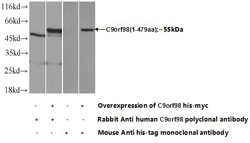Transfected HEK-293 cells were subjected to SDS PAGE followed by western blot with Catalog No:108807(C9orf98 Antibody) at dilution of 1:700