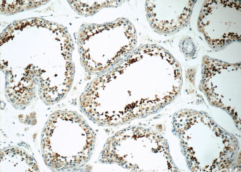Immunohistochemistry of paraffin-embedded human testis tissue slide using Catalog No:115527(SPACA1 Antibody) at dilution of 1:50 (under 10x lens)