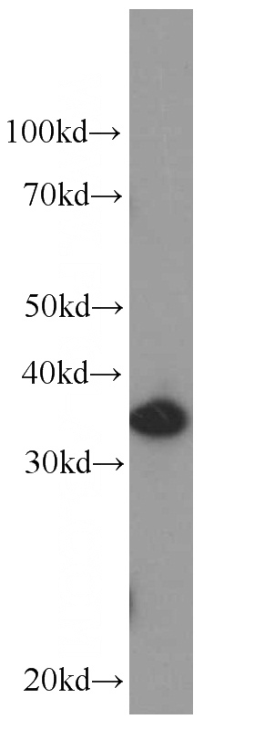 Raji cells were subjected to SDS PAGE followed by western blot with Catalog No:107393(IL22RA2 Antibody) at dilution of 1:1000