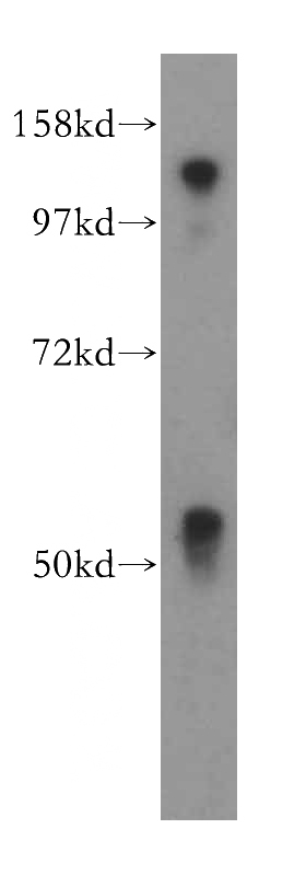 HeLa cells were subjected to SDS PAGE followed by western blot with Catalog No:112727(MOF antibody) at dilution of 1:500