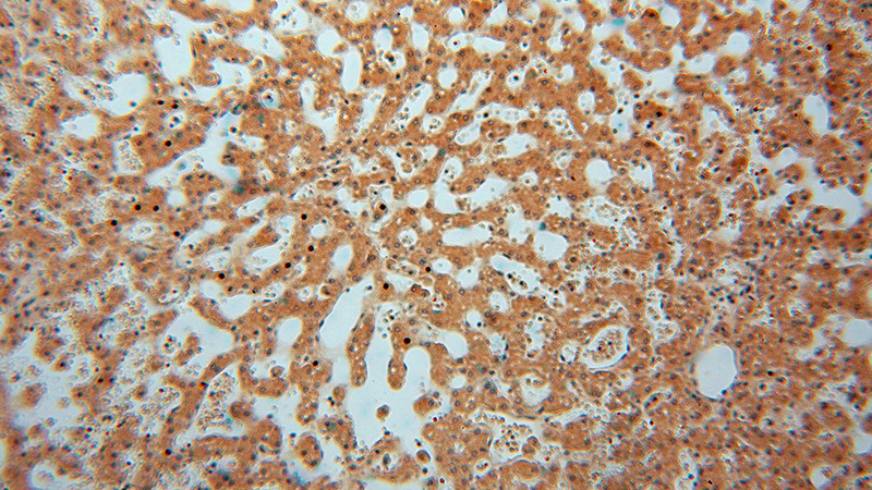 Immunohistochemical of paraffin-embedded human liver using Catalog No:108616(C18orf55 antibody) at dilution of 1:100 (under 10x lens)