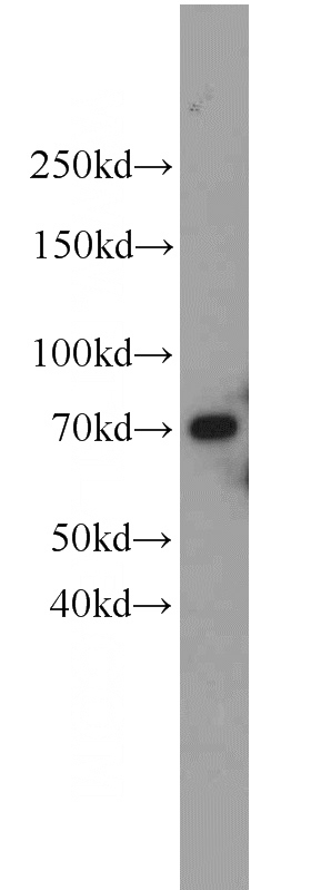 rat brain tissue were subjected to SDS PAGE followed by western blot with Catalog No:116658(UBQLN2 antibody) at dilution of 1:800