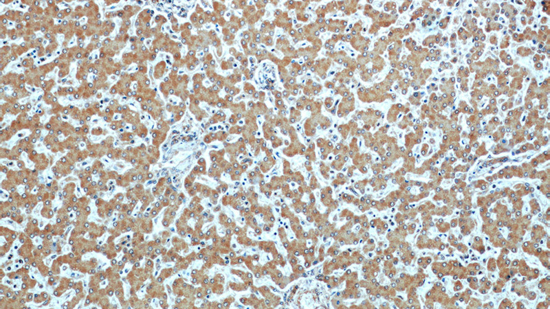 Immunohistochemical of paraffin-embedded human liver using Catalog No:107526(SERPINA10 antibody) at dilution of 1:50 (under 10x lens)