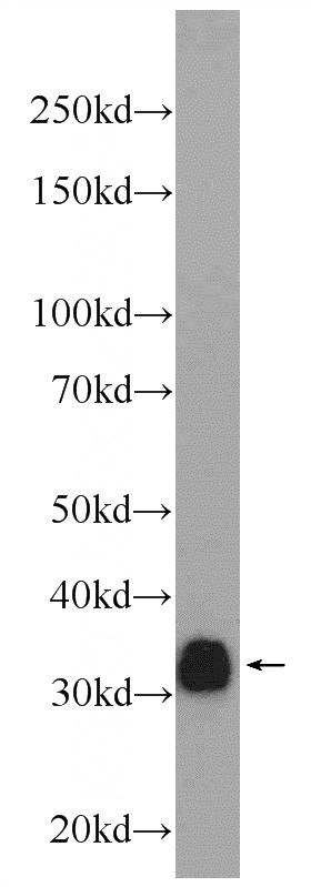 Raji cells were subjected to SDS PAGE followed by western blot with Catalog No:109005(MS4A1,CD20 Antibody) at dilution of 1:1000