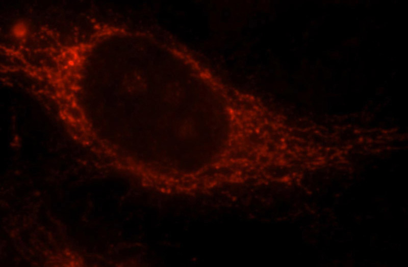 Immunofluorescent analysis of Hela cells, using CABC1 antibody Catalog No:108754 at 1:25 dilution and Rhodamine-labeled goat anti-rabbit IgG (red).