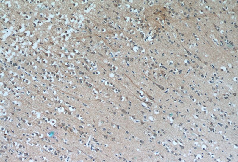 Immunohistochemistry of paraffin-embedded human brain tissue slide using Catalog No:107414(MAOB Antibody) at dilution of 1:50(under 10x lens)
