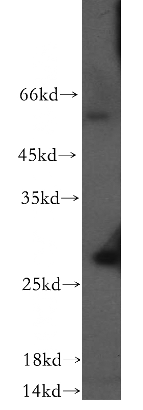 human heart tissue were subjected to SDS PAGE followed by western blot with Catalog No:114459(RAB7B antibody) at dilution of 1:200