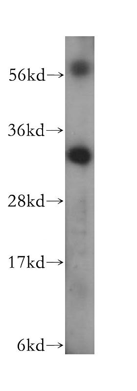 Jurkat cells were subjected to SDS PAGE followed by western blot with Catalog No:116228(TRADD antibody) at dilution of 1:500