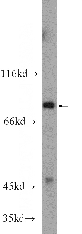 fetal human brain tissue were subjected to SDS PAGE followed by western blot with Catalog No:111337(HAP1 Antibody) at dilution of 1:600