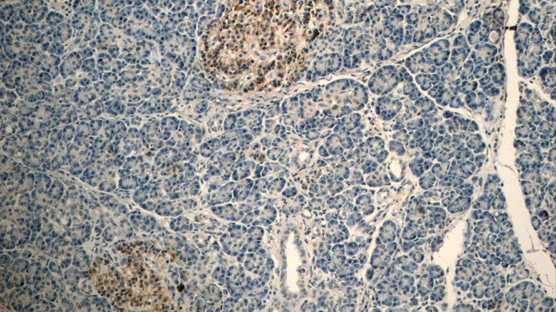 Immunohistochemistry of paraffin-embedded human pancreas tissue slide using Catalog No:107034(Caspase 9 Antibody) at dilution of 1:50 (under 10x lens)