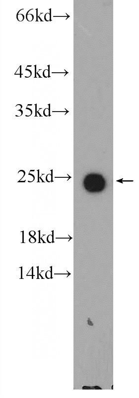 human plasma tissue were subjected to SDS PAGE followed by western blot with Catalog No:108039(APOM Antibody) at dilution of 1:1000