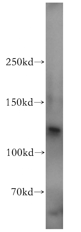 mouse liver tissue were subjected to SDS PAGE followed by western blot with Catalog No:116979(WWP2 antibody) at dilution of 1:500