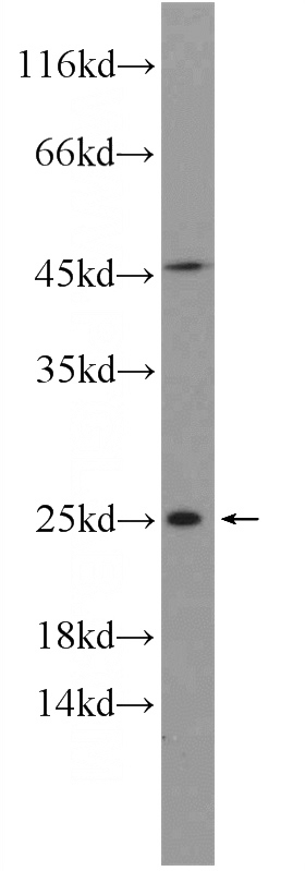 human plasma tissue were subjected to SDS PAGE followed by western blot with Catalog No:111658(IL11 Antibody) at dilution of 1:300